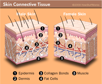 cellulite, what is cellulite, what causes cellulite, cellulitis, pictures of cellulite, cellulite pictures, cellulite photos